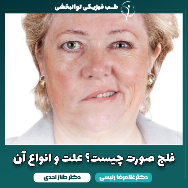 فلج صورت