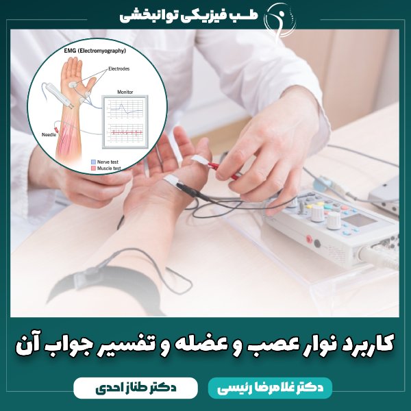 نوار عصب و عضله