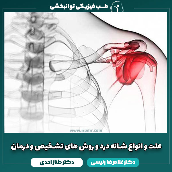 علت و انواع شانه درد + تشخیص و درمان درد شانه