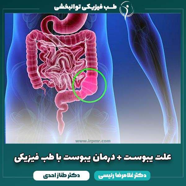علت یبوست + درمان یبوست با طب فیزیکی