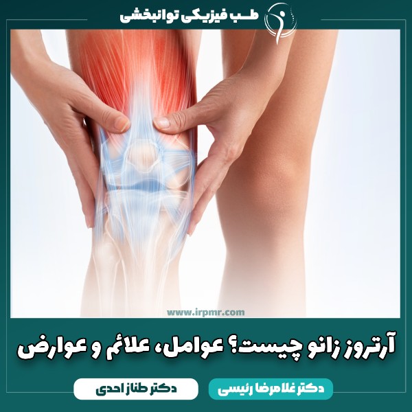 آرتروز زانو چیست؟ عوامل، علائم و عوارض آرتروز زانو