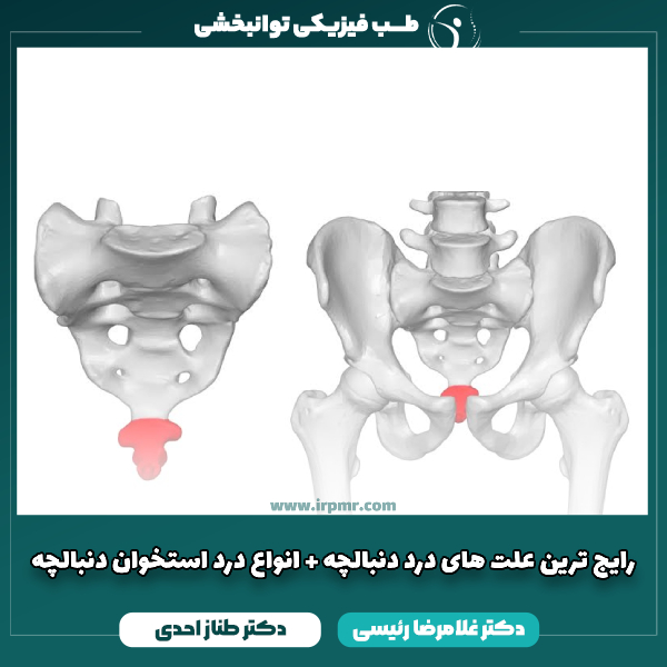رایج ترین علت های درد دنبالچه + انواع درد استخوان دنبالچه